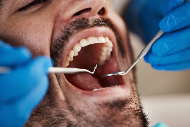 Dental X-Rays and Imaging in Greentown, IN